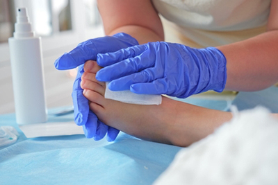 Podiatrist providing wound care treatment